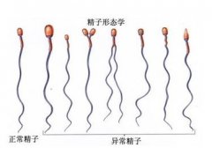 专家解疑少精弱精