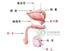 阴茎畸形应该做哪些检查？